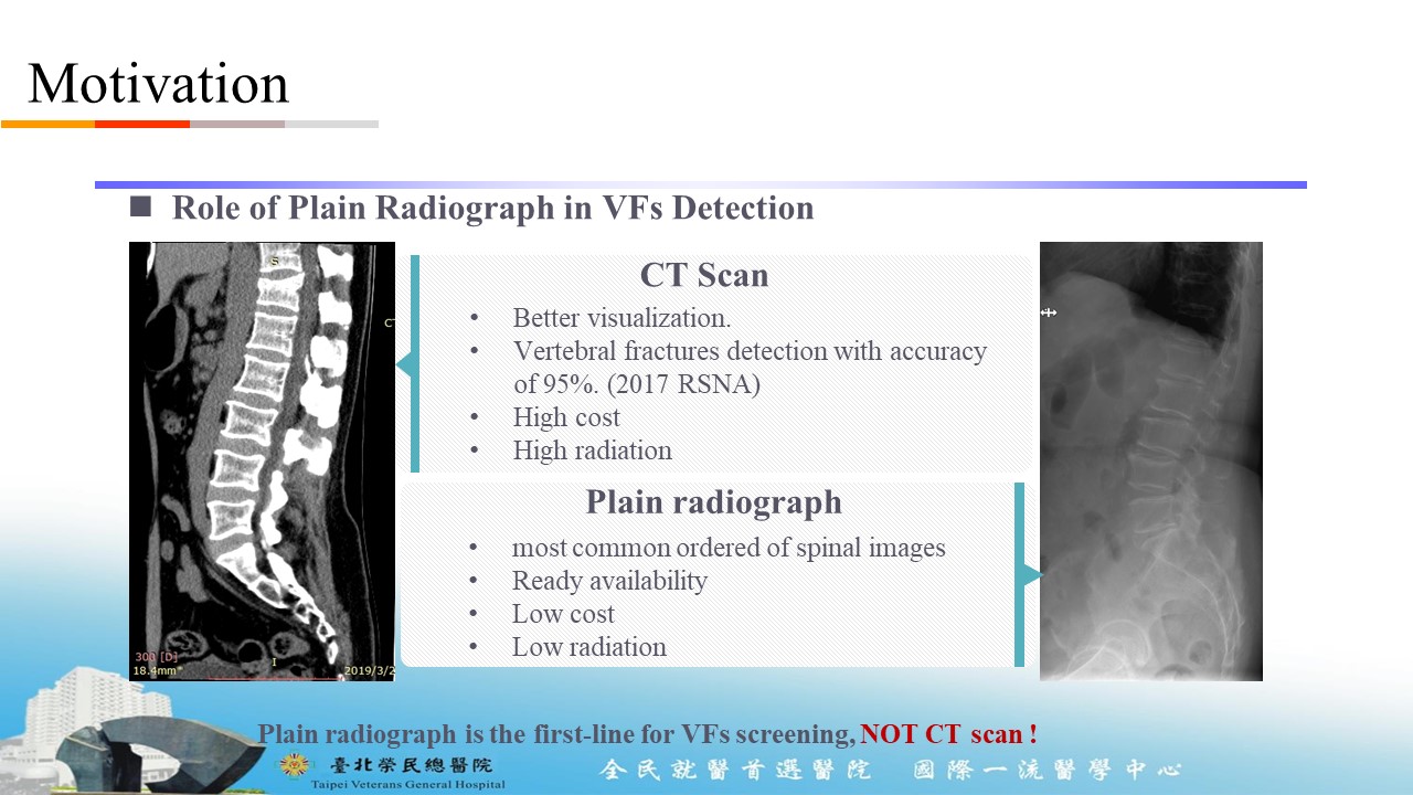 Application of artificial intelligence deep learning ensemble model for detection of thoraciclumbar vertebral fractures on plain lateral radiographs