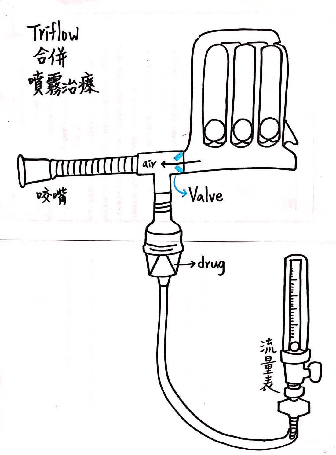 Pipeline coupling device-(Magic T, easy to suck: Two in one breathing treatment of T-tube)