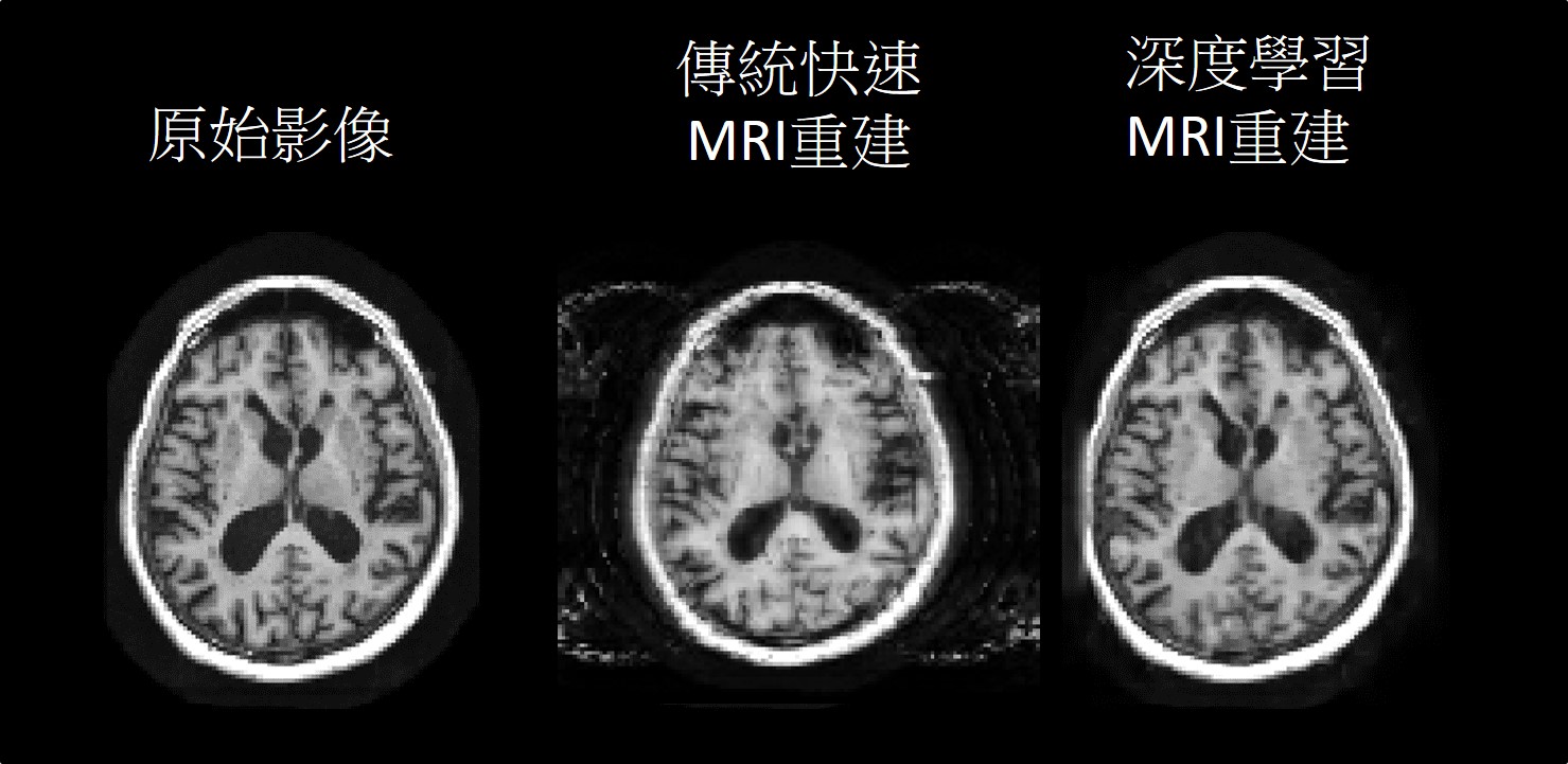 Reconstruction of Accelerated MRI using Deep Learning