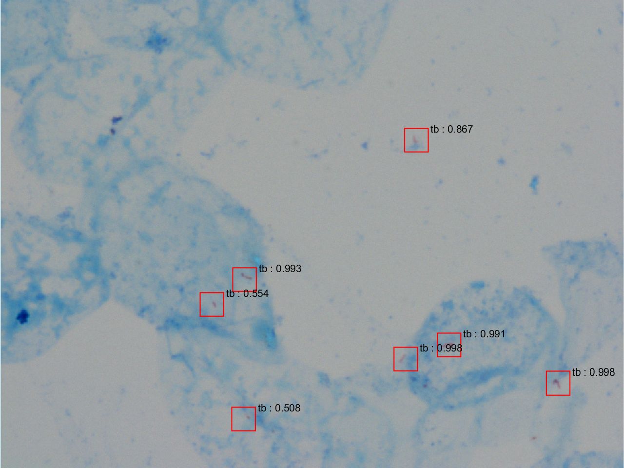 卷積類神經網路於顯微鏡結核桿菌辨識技術