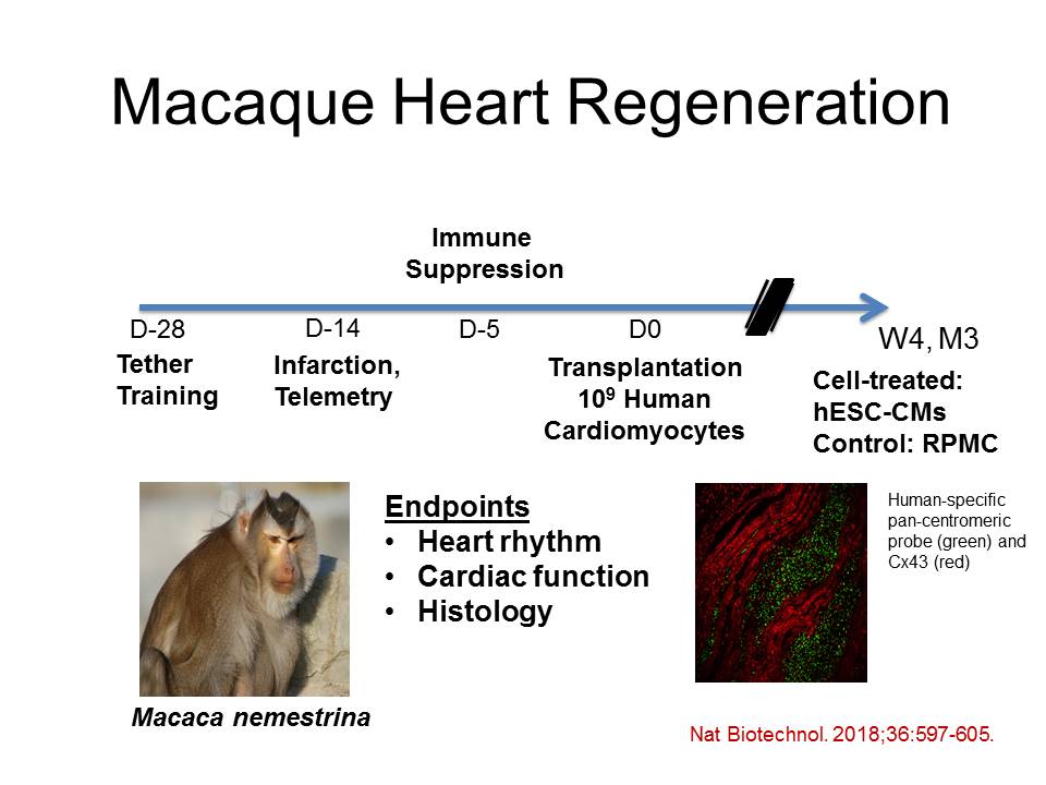 Human pluripotent stem cell therapy for ischemic heart disease