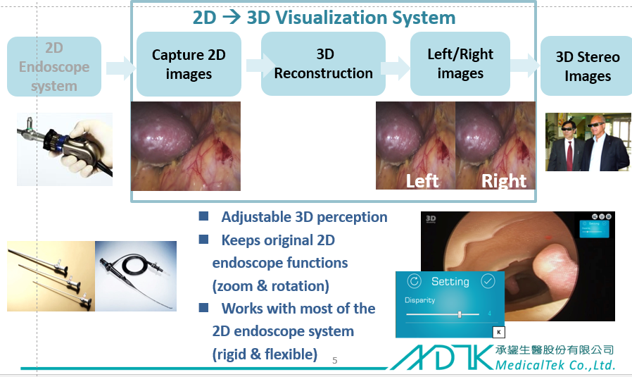 MonoStereo(R) 3D Endoscope Visualization System