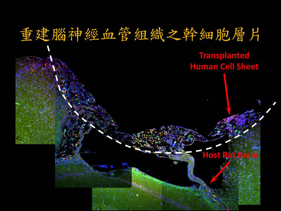 還我健康的腦──重建腦神經血管組織之幹細胞層片