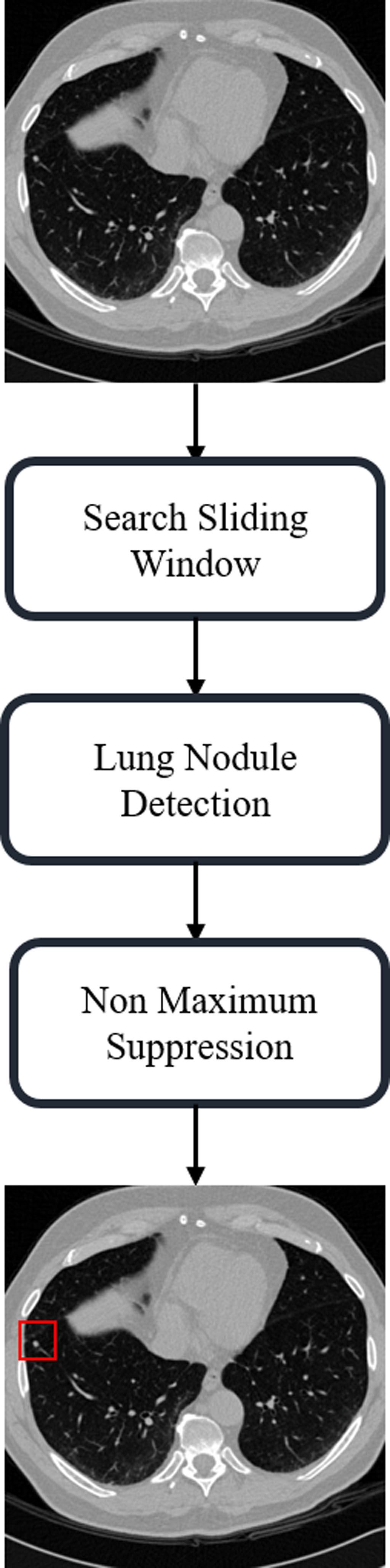 應用三維膠囊網路於肺部電腦斷層影像之結節偵測