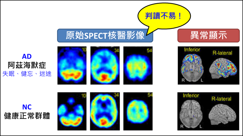Development of Functional Images AnalysisAssistant Platform for Dementia
