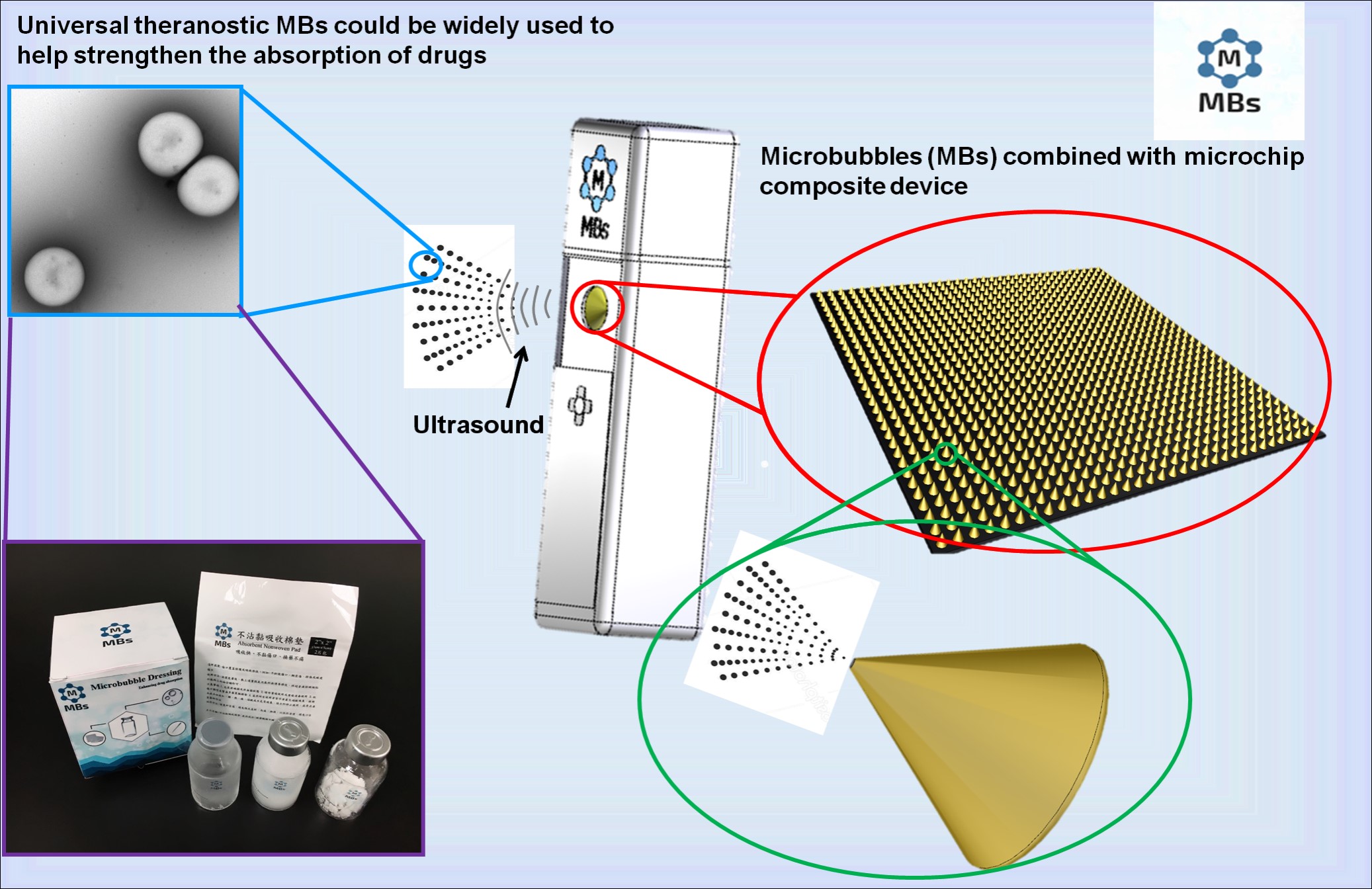 A composite ultrasound medical device for microbubble vaccinesthe sputtering lysozyme microbubble for trachea therapy