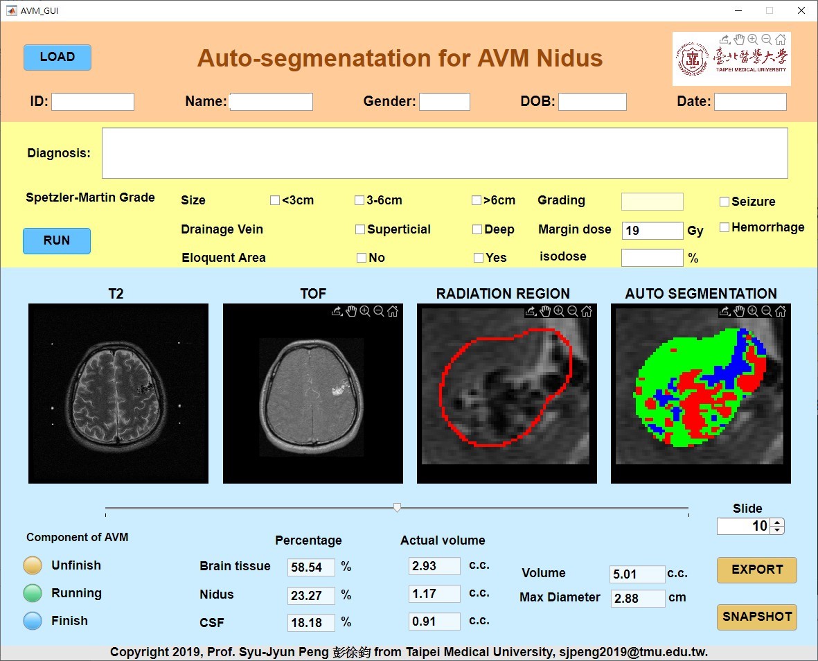 Auto Segmentation App. for Predication of Arteriovenous Malformation