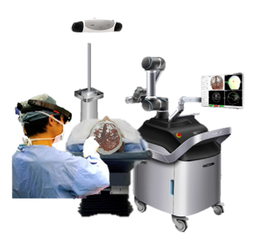 AR輔助3D腦手術用導航系統