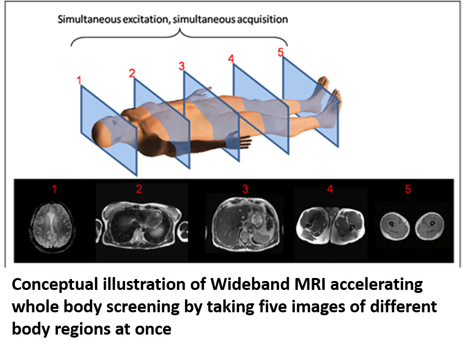 Wideband MRI Technique