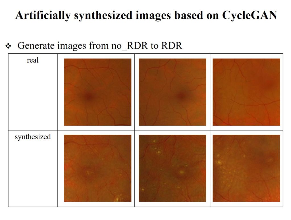 Study the Use of Image Generation Techniques to Improve the Performance of AI Assisted Diabetic Retinopathy Diagnoses