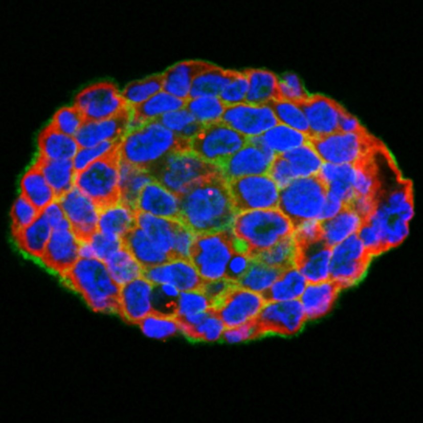 單一癌細胞之3D球體快速培養及其臨床應用
