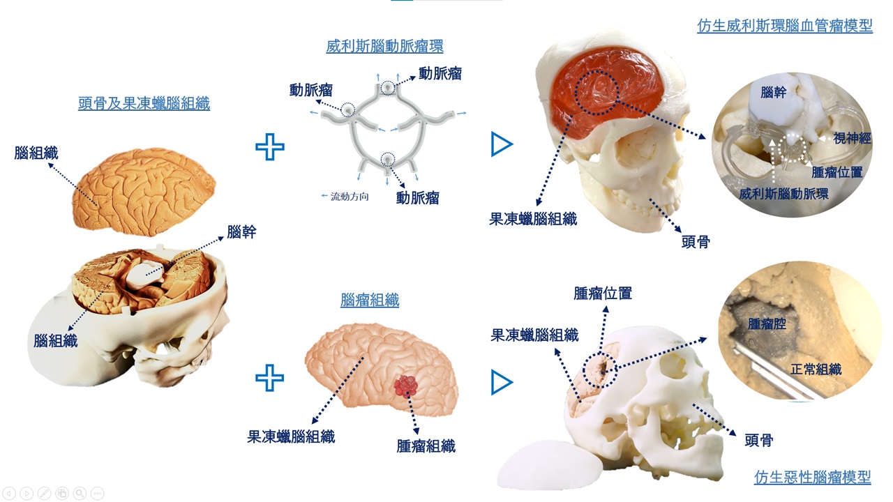 利用先進製程提升臨床腦神經外科醫師訓練品質-仿生腦模擬器