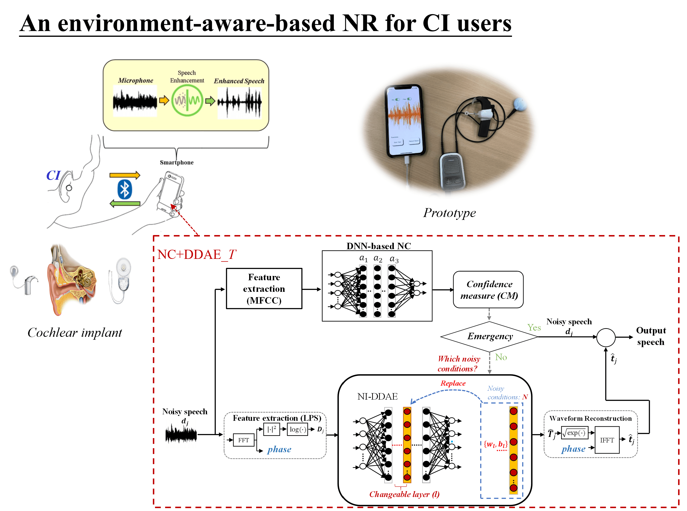 Bionic Organ of Precision Hearing: Deep Learning-Based Neural Network AIoT Approach for Noise Reduction in Next Generation Cochlear Implant