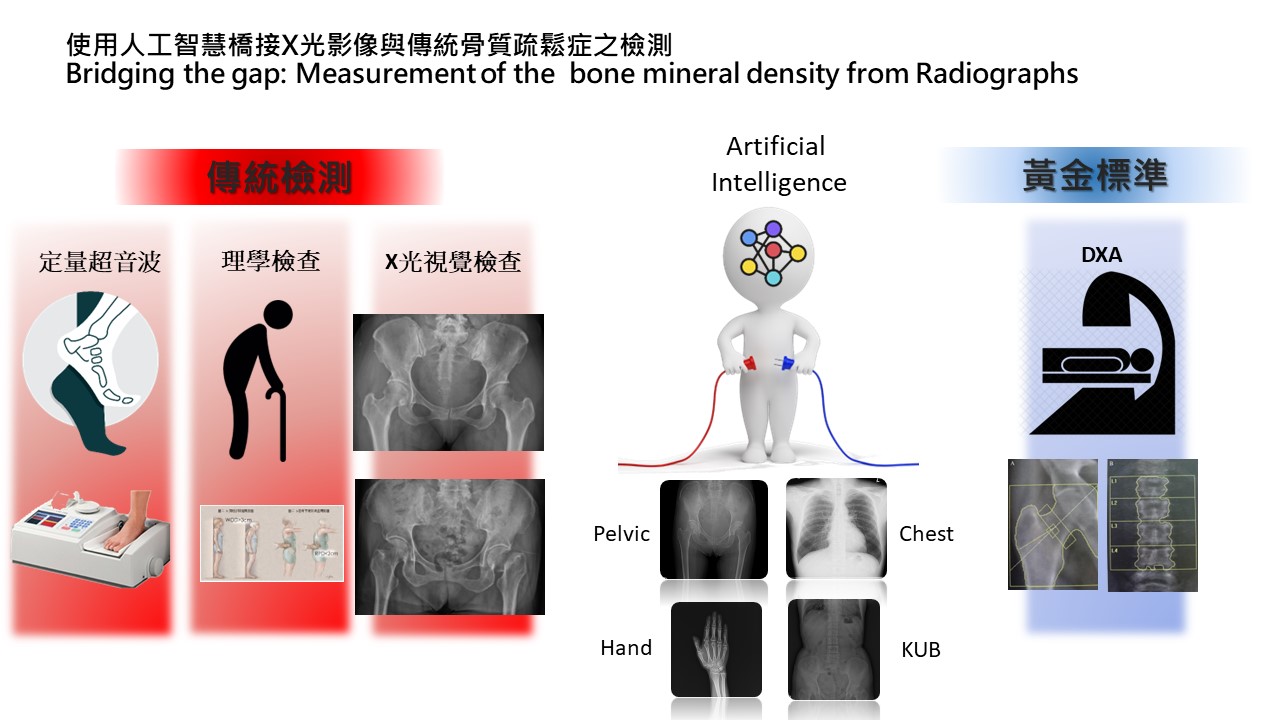 Inference of bone density from X-ray using AI methods
