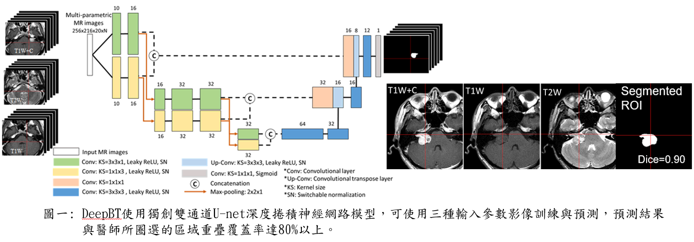 DeepBT intelligent system for precision medicine in brain tumors: longitudinal lesion segmentationoutcome prediction after radiosurgery