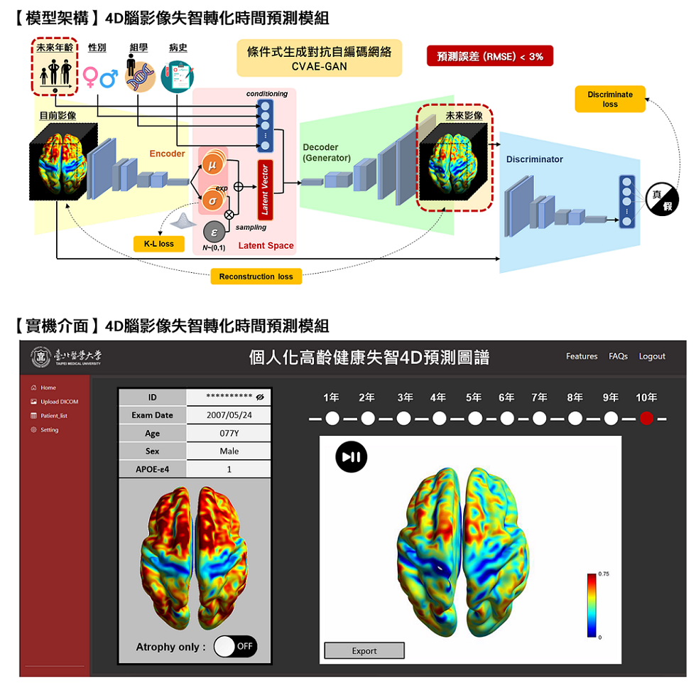 Personalized 4D AI prediction of brain agingdementia using multi-module platform