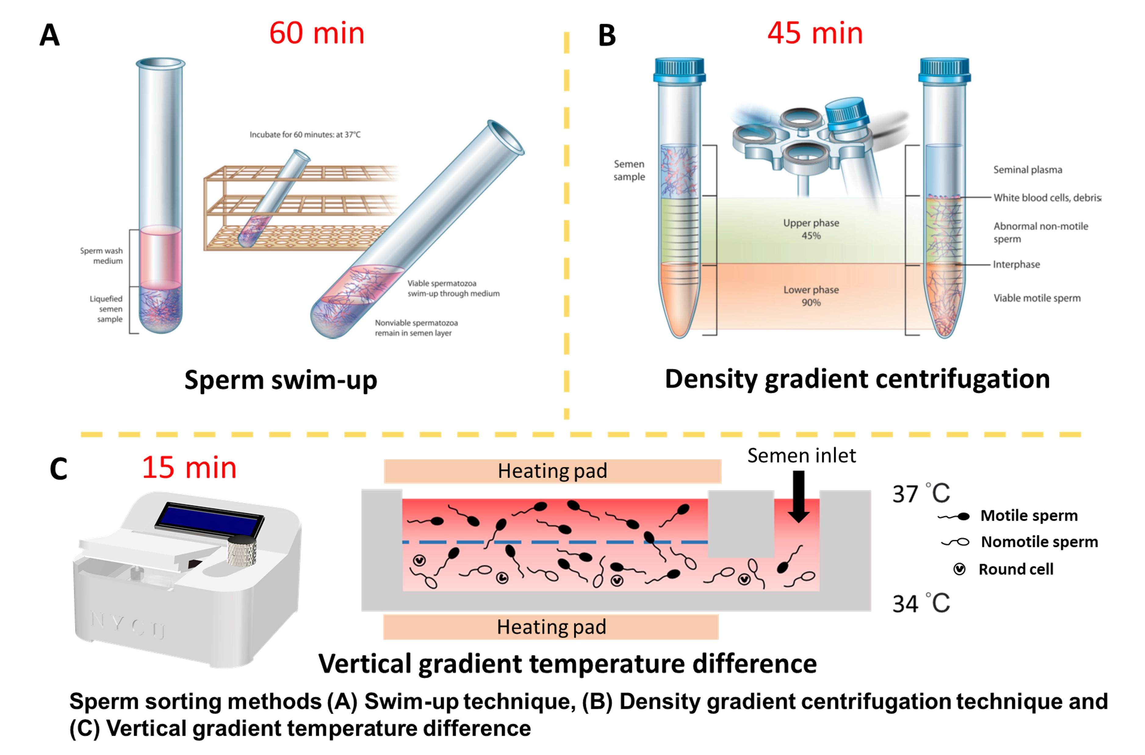 High-throughput sperm sorting chip with vertical gradient temperature difference