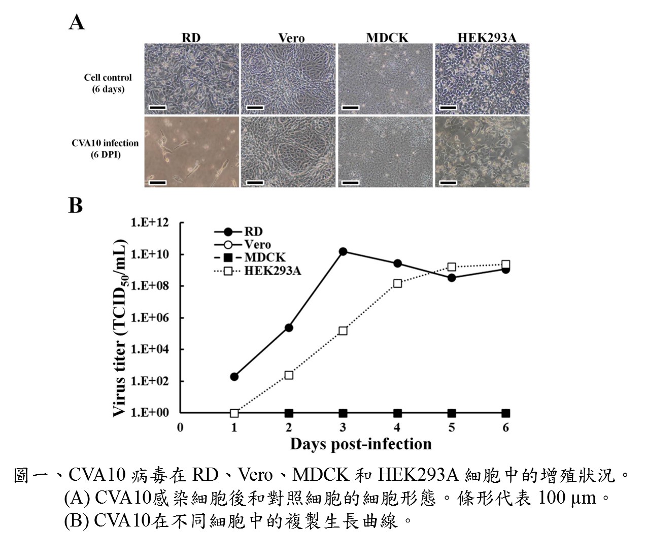 Development of HEK293 cell culture process for Coxsackievirus vaccine production