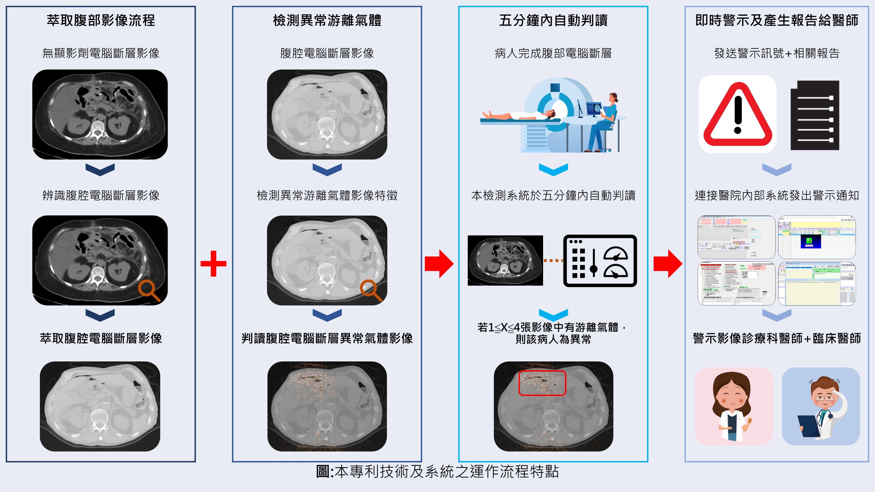 A deep learning-powered novel artificial intelligence algorithmsystem to assist in the identification of pneumoperitoneum on abdominal computed tomography