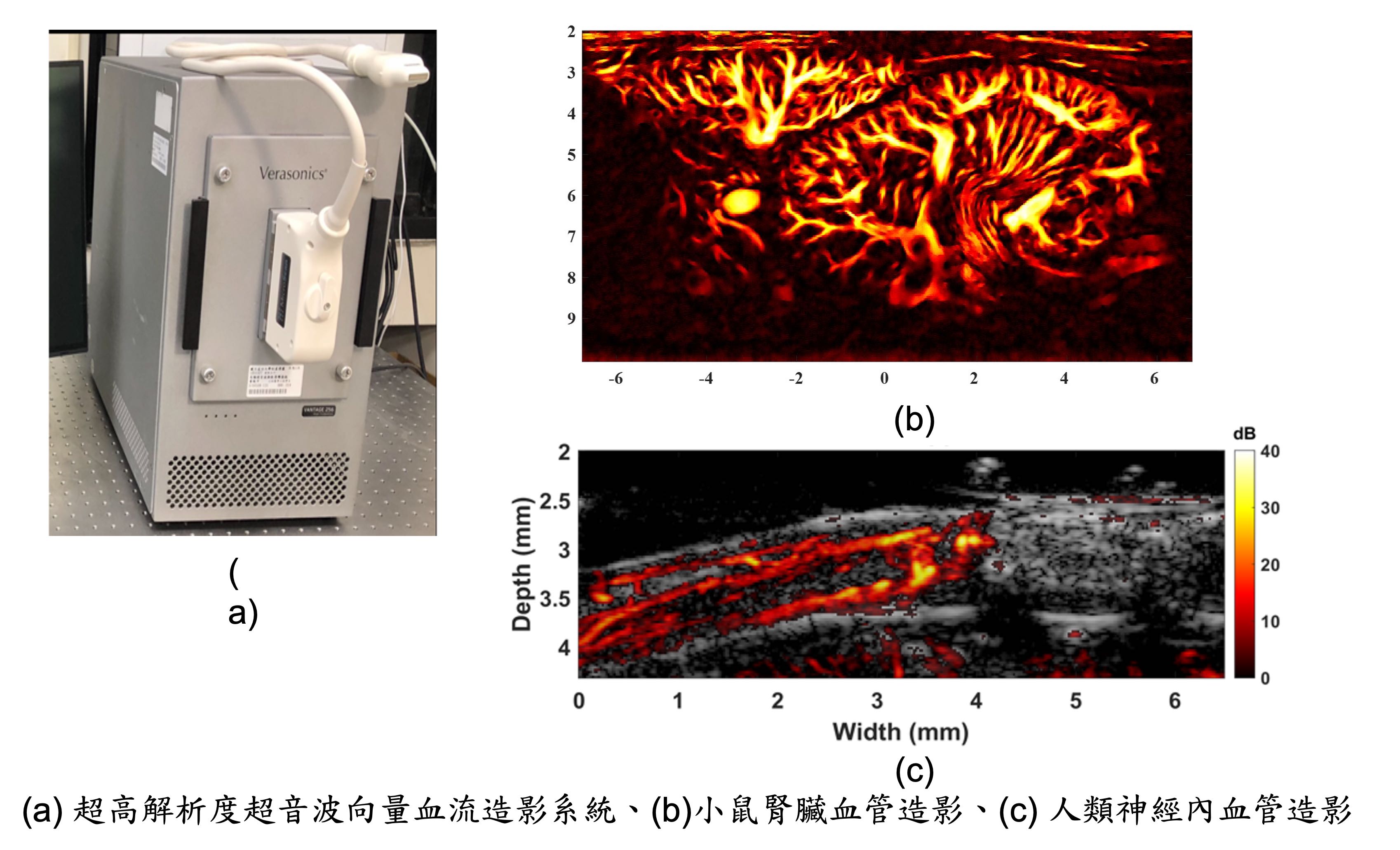 Super resolution ultrasound vector blood flow imaging