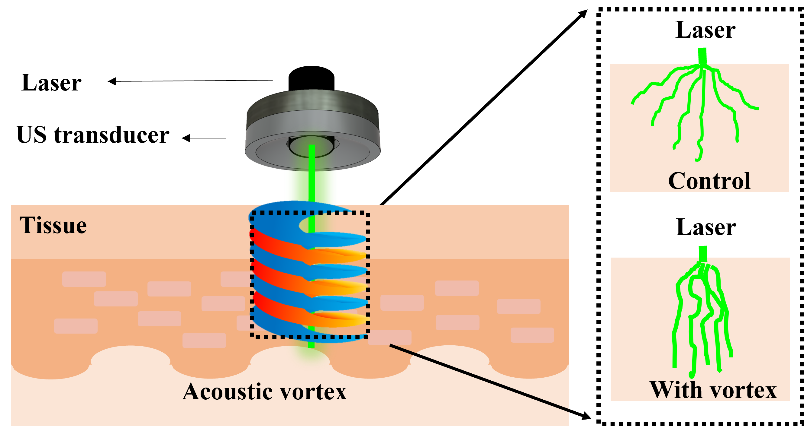 Acoustic vortex light guide system