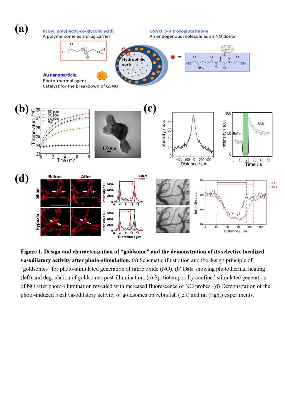 Revolutionizing Heart Attack Treatment: The Fusion of Nanomedicine and Optofluidic Catheters