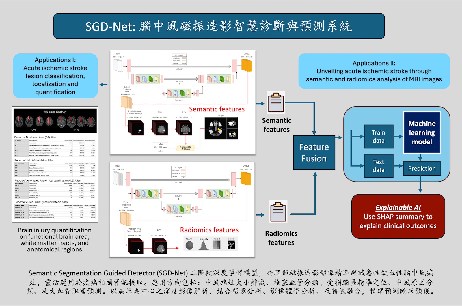 SGD-Net: Intelligent Diagnostic and Predictive System for Stroke Using MRI images