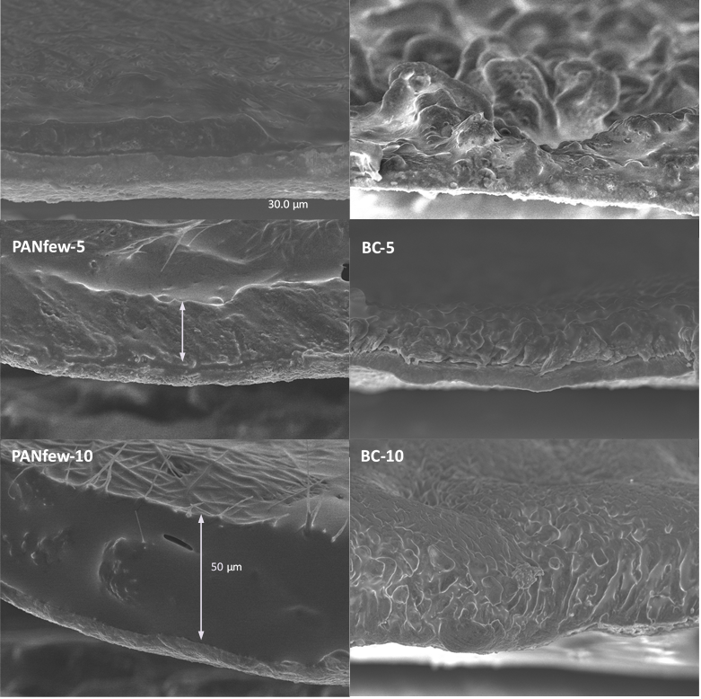 Fabrication of high-capacity and high-safety lithium half-cells and pouch cells was achieved through the integrated development of anode materials, protective interlayers, and electrolyte systems.