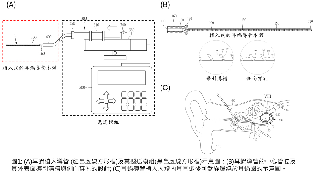 耳蝸植入導管及其細胞遞送裝置
